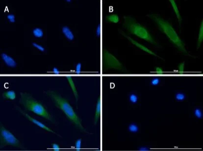 Immunocytochemistry/ Immunofluorescence - Anti-NAK/TBK1 antibody (AB235253)