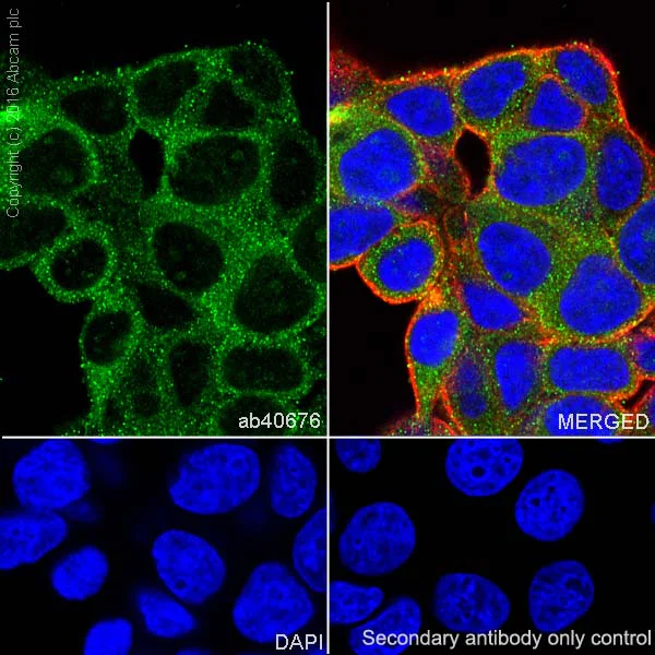 Immunocytochemistry/ Immunofluorescence - Anti-NAK/TBK1 antibody [EP611Y] - BSA and Azide free (AB186470)