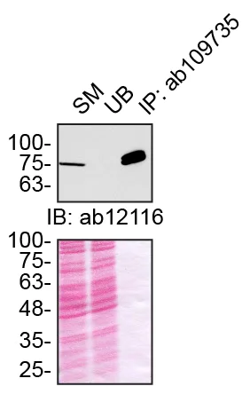 Immunoprecipitation - Anti-NAK/TBK1 antibody [EPR2867(2)-19] (AB109735)