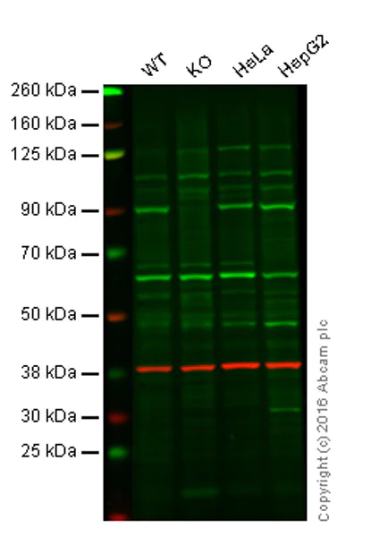 Western blot - Anti-NAK/TBK1 antibody [EPR2867(2)-19] (AB109735)