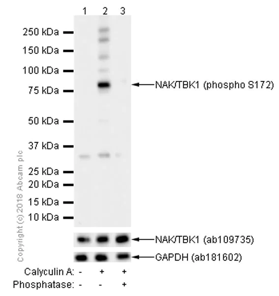 Western blot - Anti-NAK/TBK1 (phospho S172) antibody [EPR2867(2)] (AB109272)