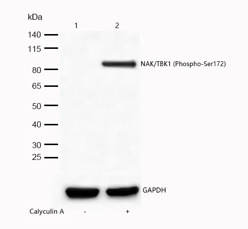Western blot - Anti-NAK/TBK1 (phospho S172) antibody [SR2251] (AB326661)