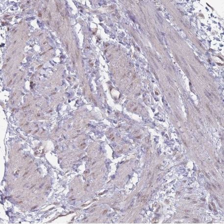 Immunohistochemistry (Formalin/PFA-fixed paraffin-embedded sections) - Anti-Naked1 antibody (AB185082)