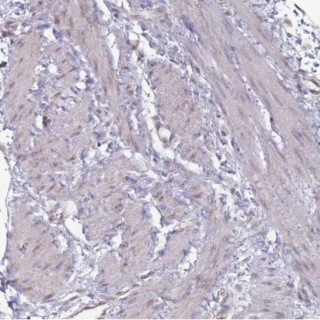 Immunohistochemistry (Formalin/PFA-fixed paraffin-embedded sections) - Anti-Naked1 antibody (AB185082)