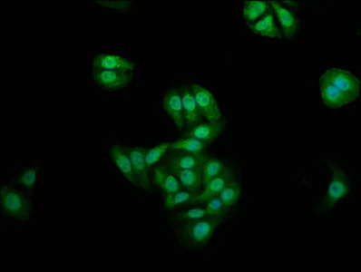 Immunocytochemistry/ Immunofluorescence - Anti-Naked1 antibody (AB237535)