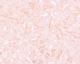 Immunohistochemistry (Formalin/PFA-fixed paraffin-embedded sections) - Anti-NALP12/NLRP12 antibody (AB105409), expandable thumbnail