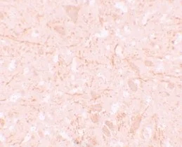 Immunohistochemistry (Formalin/PFA-fixed paraffin-embedded sections) - Anti-NALP12/NLRP12 antibody (AB105409)