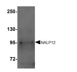 Western blot - Anti-NALP12/NLRP12 antibody (AB105409), expandable thumbnail