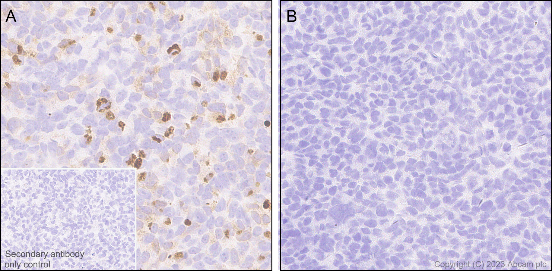 Immunohistochemistry (Formalin/PFA-fixed paraffin-embedded sections) - Anti-NALP12/NLRP12 antibody [EPR26985-39] (AB308250), expandable thumbnail