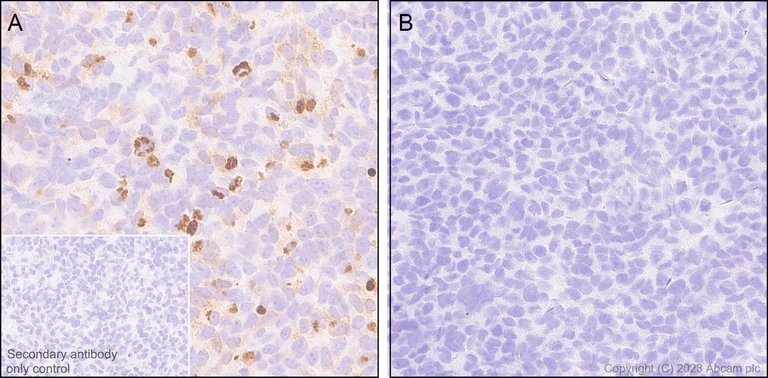 Immunohistochemistry (Formalin/PFA-fixed paraffin-embedded sections) - Anti-NALP12/NLRP12 antibody [EPR26985-39] (AB308250)