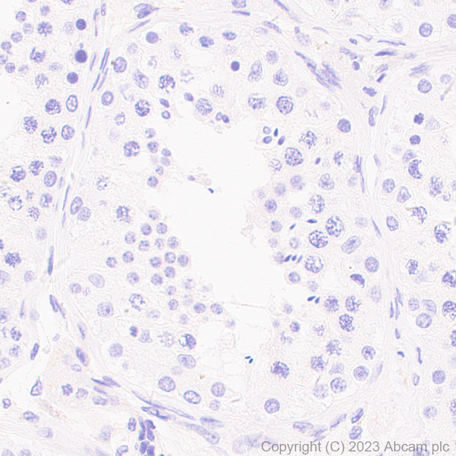 Immunohistochemistry (Formalin/PFA-fixed paraffin-embedded sections) - Anti-NALP12/NLRP12 antibody [EPR26985-39] (AB308250), expandable thumbnail
