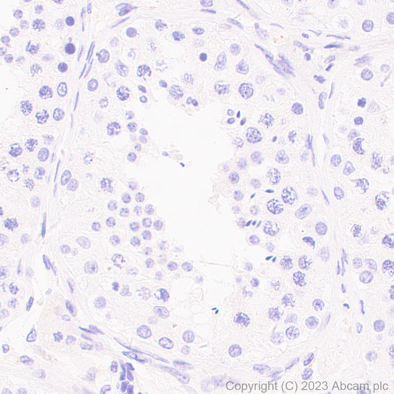 Immunohistochemistry (Formalin/PFA-fixed paraffin-embedded sections) - Anti-NALP12/NLRP12 antibody [EPR26985-39] (AB308250)