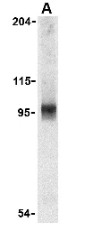 Western blot - Anti-NALP2 antibody (AB36850)