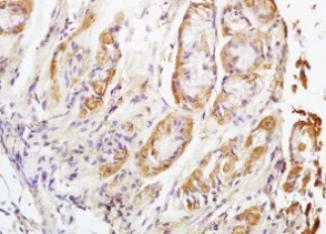 Immunohistochemistry (Formalin/PFA-fixed paraffin-embedded sections) - Anti-NALP4 antibody (AB204111)