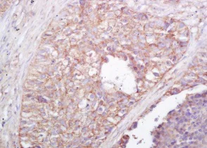 Immunohistochemistry (Formalin/PFA-fixed paraffin-embedded sections) - Anti-NALP4 antibody (AB204111)
