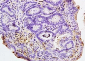 Immunohistochemistry (Formalin/PFA-fixed paraffin-embedded sections) - Anti-NALP4 antibody (AB204111)