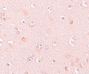 Immunohistochemistry (Formalin/PFA-fixed paraffin-embedded sections) - Anti-NALP5 antibody (AB105324)