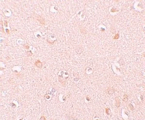 Immunohistochemistry (Formalin/PFA-fixed paraffin-embedded sections) - Anti-NALP5 antibody (AB105324)