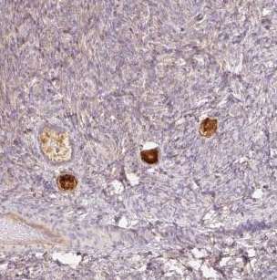 Immunohistochemistry (Formalin/PFA-fixed paraffin-embedded sections) - Anti-NALP5 antibody (AB185679)