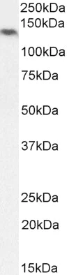 Western blot - Anti-NALP5 antibody - C-terminal (AB215180)