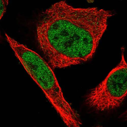 Immunocytochemistry/ Immunofluorescence - Anti-Nance-Horan Syndrome Protein antibody (AB122177)