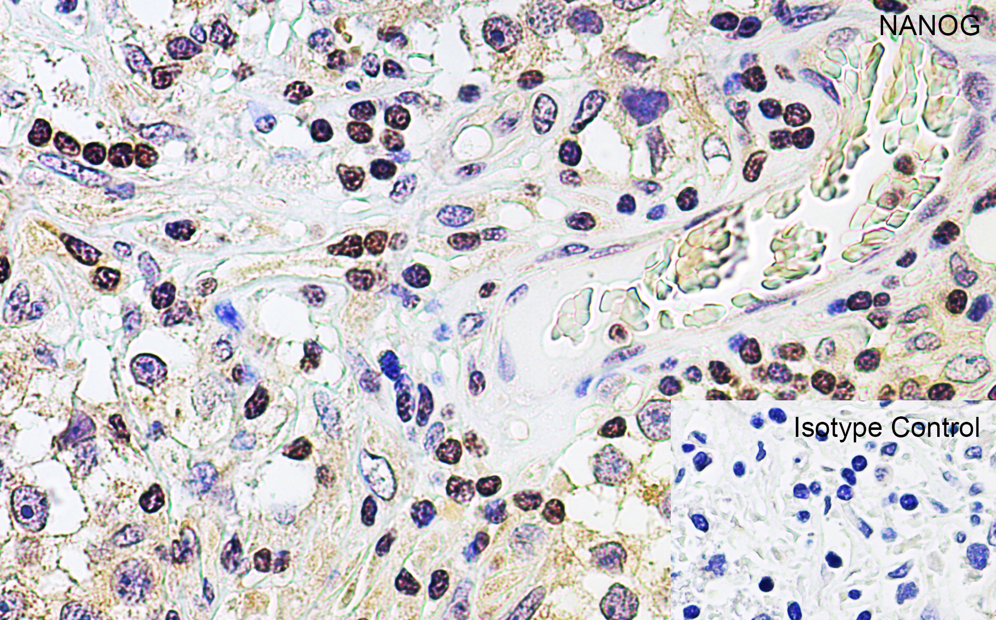 Immunohistochemistry (Formalin/PFA-fixed paraffin-embedded sections) - Anti-Nanog antibody (AB106465), expandable thumbnail