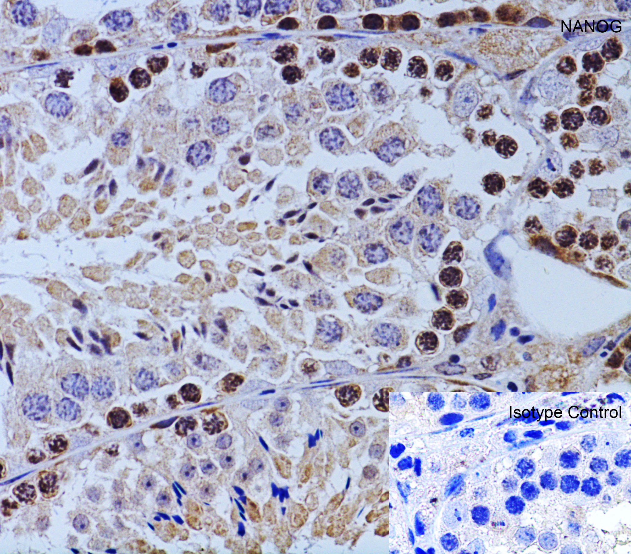 Immunohistochemistry (Formalin/PFA-fixed paraffin-embedded sections) - Anti-Nanog antibody (ab106465), expandable thumbnail