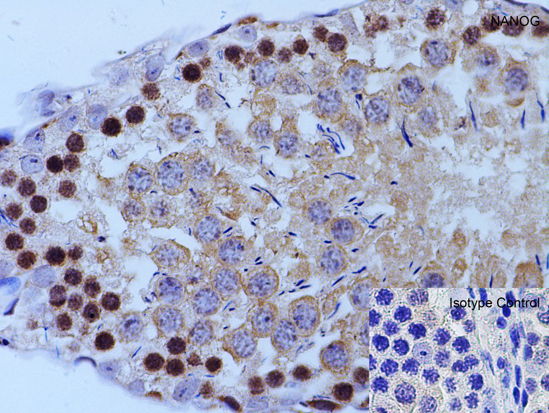 Immunohistochemistry (Formalin/PFA-fixed paraffin-embedded sections) - Anti-Nanog antibody (ab106465), expandable thumbnail