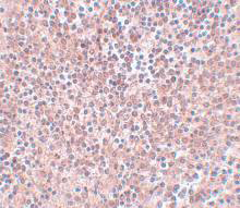 Immunohistochemistry (Formalin/PFA-fixed paraffin-embedded sections) - Anti-Nanog antibody (AB106465), expandable thumbnail