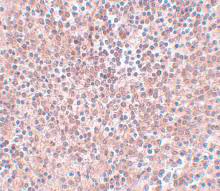 Immunohistochemistry (Formalin/PFA-fixed paraffin-embedded sections) - Anti-Nanog antibody (AB106465)