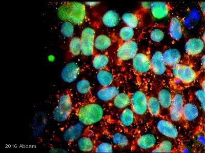 Immunocytochemistry/ Immunofluorescence - Anti-Nanog antibody (AB21624)