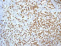 Immunohistochemistry (Formalin/PFA-fixed paraffin-embedded sections) - Anti-Nanog antibody [EPR2027(2)] - BSA and Azide free (AB218524)