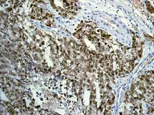 Immunohistochemistry (Formalin/PFA-fixed paraffin-embedded sections) - Anti-Nanog antibody [EPR2027(2)] - BSA and Azide free (AB218524)