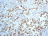 Immunohistochemistry (Formalin/PFA-fixed paraffin-embedded sections) - Anti-Nanog antibody [EPR2027(2)] - BSA and Azide free (AB218524)