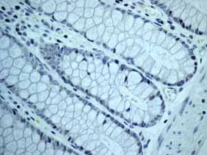Immunohistochemistry (Formalin/PFA-fixed paraffin-embedded sections) - Anti-Nanog antibody [EPR2027(2)] - BSA and Azide free (AB218524)