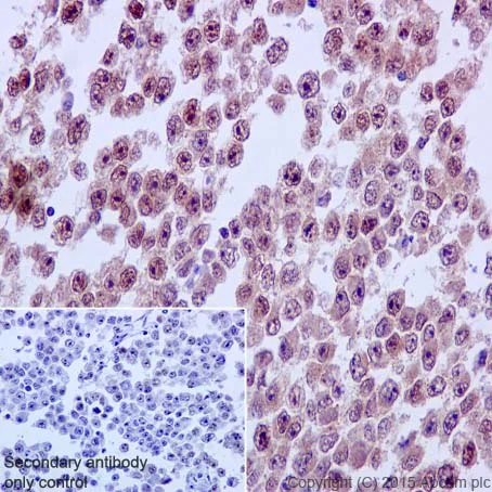 Immunohistochemistry (Formalin/PFA-fixed paraffin-embedded sections) - Anti-Nanog antibody [EPR2027(2)] - BSA and Azide free (AB218524)