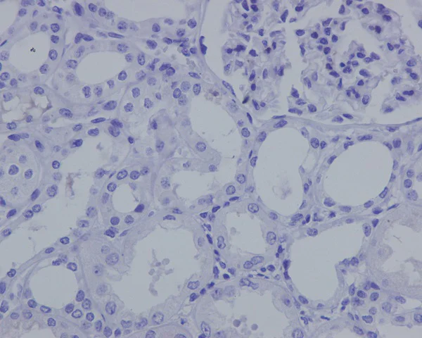Immunohistochemistry (Formalin/PFA-fixed paraffin-embedded sections) - Anti-Nanog antibody [EPR2027(2)] - BSA and Azide free (AB218524)