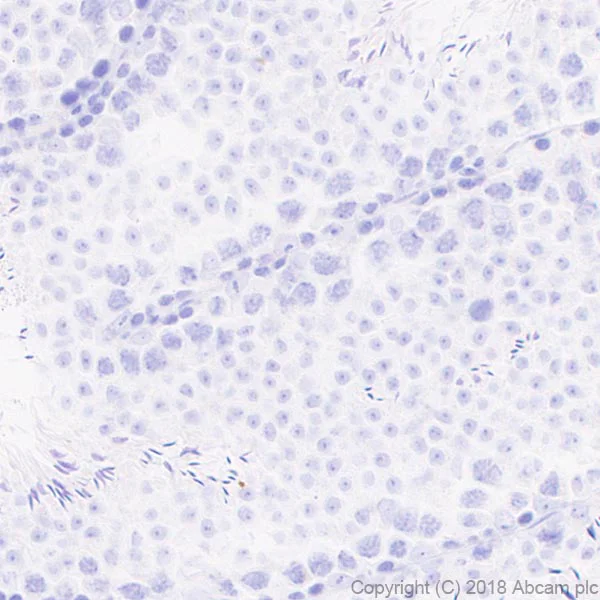 Immunohistochemistry (Formalin/PFA-fixed paraffin-embedded sections) - Anti-Nanog antibody [EPR20694] - ChIP Grade (AB214549)
