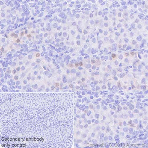 Immunohistochemistry (Formalin/PFA-fixed paraffin-embedded sections) - Anti-Nanog antibody [EPR20694] - ChIP Grade (AB214549)