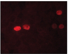 Immunocytochemistry/ Immunofluorescence - Anti-Nanog antibody [NNG-811] (AB62734), expandable thumbnail
