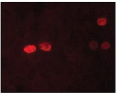 Immunocytochemistry/ Immunofluorescence - Anti-Nanog antibody [NNG-811] (AB62734)