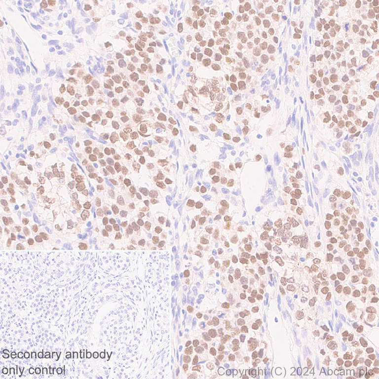 Immunohistochemistry (Formalin/PFA-fixed paraffin-embedded sections) - Anti-Nanog antibody [RM1168] (AB317506)