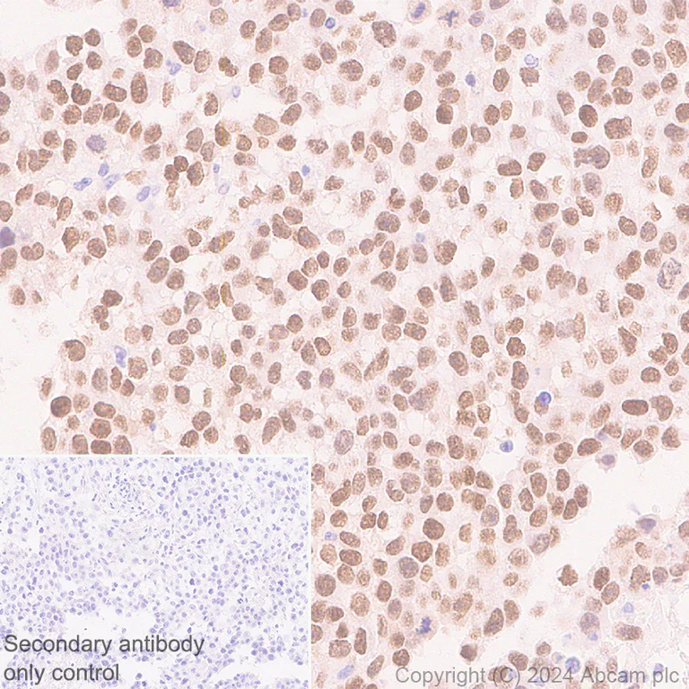 Immunohistochemistry (Formalin/PFA-fixed paraffin-embedded sections) - Anti-Nanog antibody [RM1168] - BSA and Azide free (AB317507)