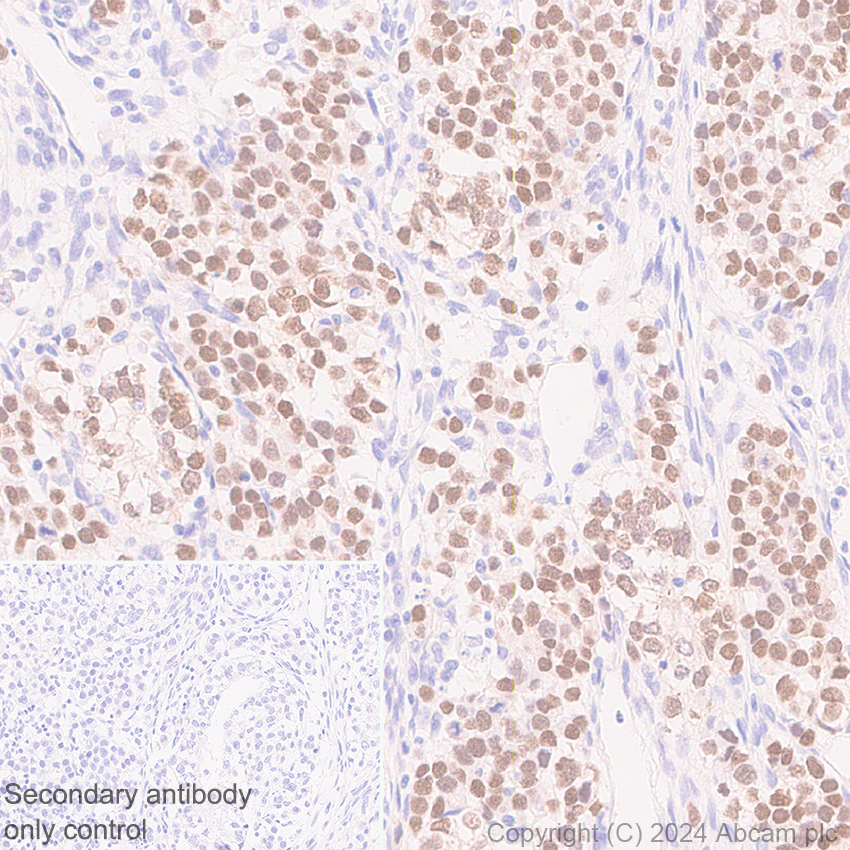 Immunohistochemistry (Formalin/PFA-fixed paraffin-embedded sections) - Anti-Nanog antibody [RM1168] - BSA and Azide free (AB317507)