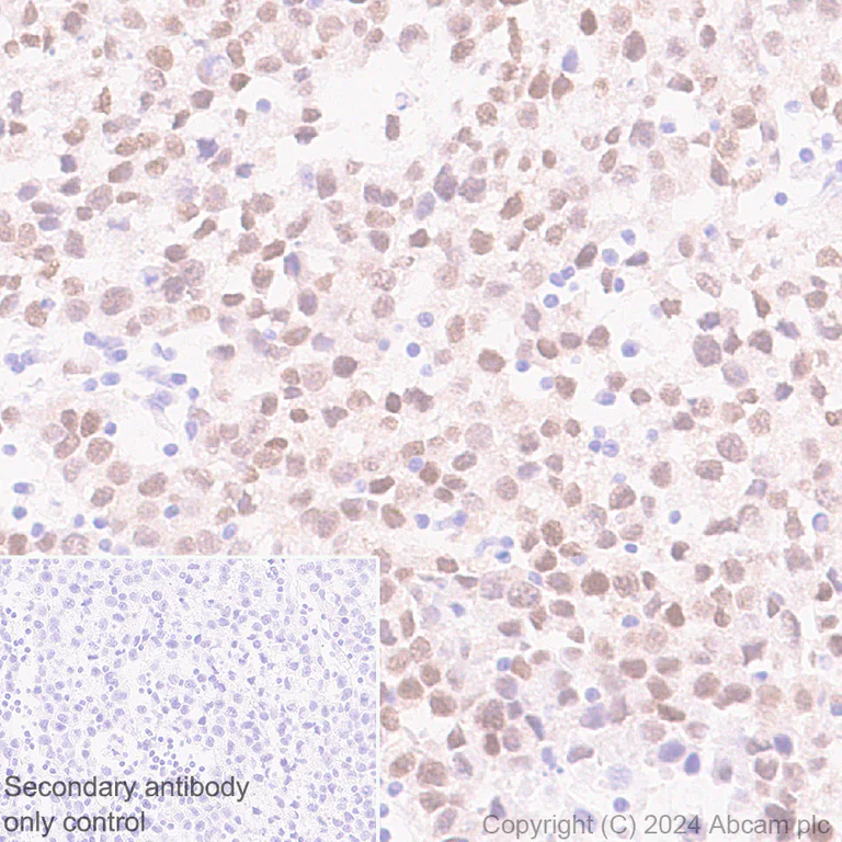 Immunohistochemistry (Formalin/PFA-fixed paraffin-embedded sections) - Anti-Nanog antibody [RM1168] - BSA and Azide free (AB317507)