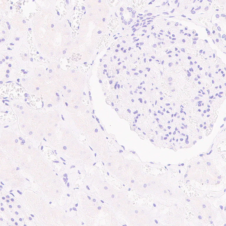 Immunohistochemistry (Formalin/PFA-fixed paraffin-embedded sections) - Anti-Nanog antibody [RM1168] - BSA and Azide free (AB317507)
