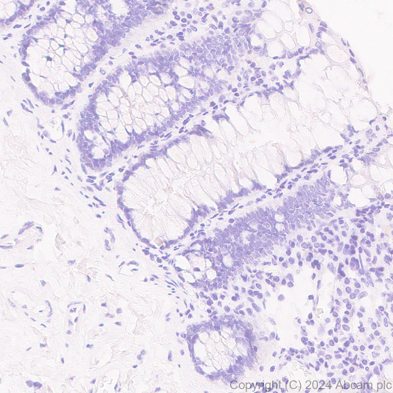 Immunohistochemistry (Formalin/PFA-fixed paraffin-embedded sections) - Anti-Nanog antibody [RM1168] - BSA and Azide free (AB317507)