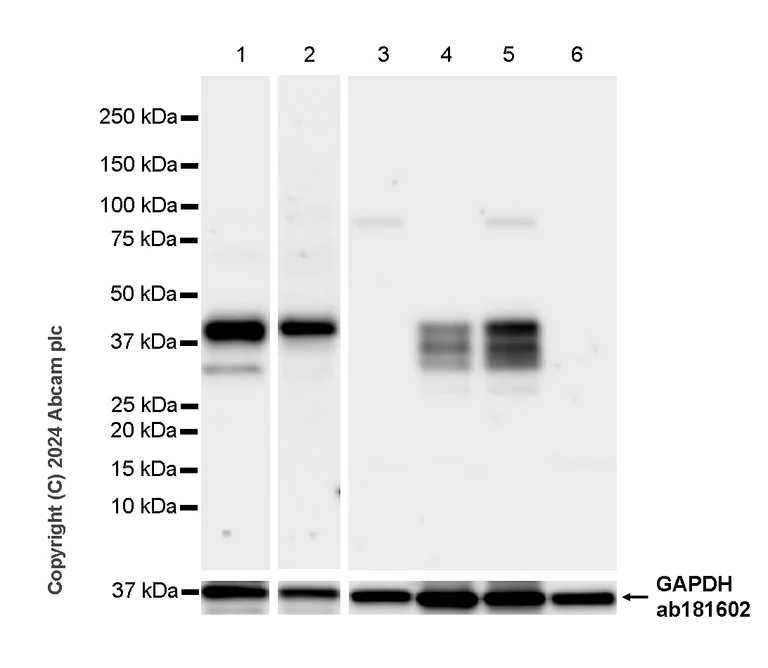 Western blot - Anti-Nanog antibody [RM1168] - BSA and Azide free (AB317507)