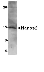 Western blot - Anti-NANOS2 antibody (AB70000)