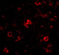 Immunocytochemistry/ Immunofluorescence - Anti-Nanos3 antibody (AB70001)